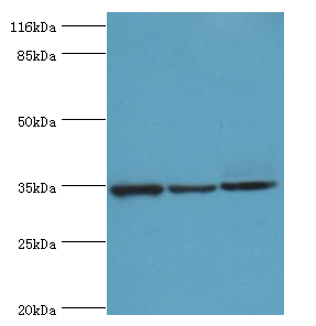 AQP4 Polyclonal Antibody