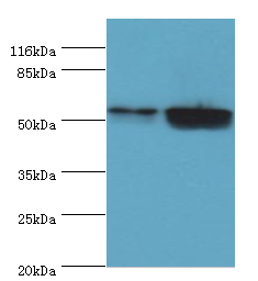 KRT8 Polyclonal Antibody