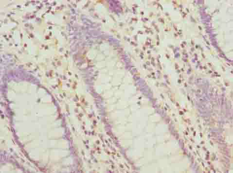 HABP2 Polyclonal Antibody