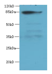 JUP Polyclonal Antibody