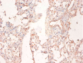 FASN Polyclonal Antibody