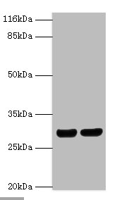 HLA-DRB1 Polyclonal Antibody (100 µl)