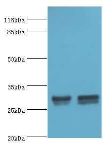 HLA-DRB1 Polyclonal Antibody