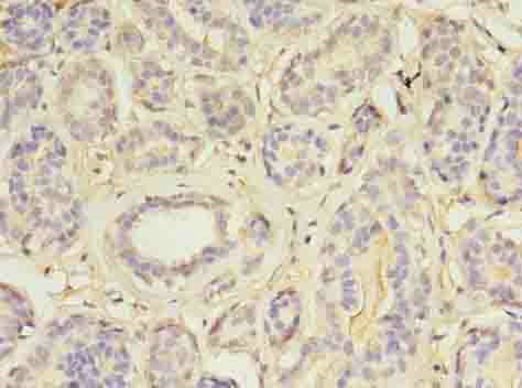 MAP3K7CL Polyclonal Antibody
