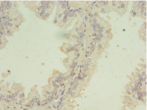 SNRPB2 Polyclonal Antibody
