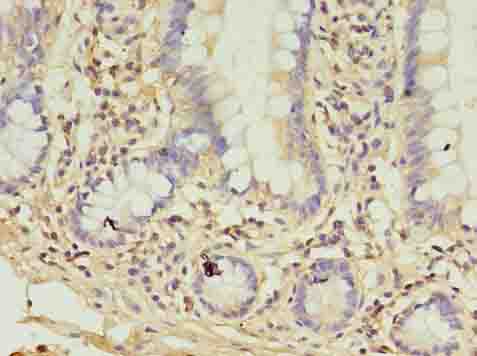 COL6A6 Polyclonal Antibody