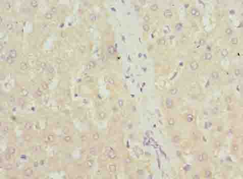 Immunohistochemistry of paraffin-embedded human liver tissue using TXNRD1 Polyclonal Antibody at dilution of 1:100