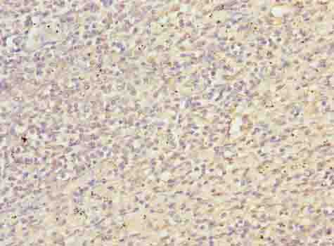 Immunohistochemistry of paraffin-embedded human spleen tissue using TXNRD1 Polyclonal Antibody at dilution of 1:100