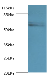 Western blot<br />All lanes: GK3P Polyclonal Antibody at 2ug/ml+Hela whole cell lysate<br />Secondary: Goat polyclonal to rabbit at 1/10000 dilution<br />Predicted band size: 61kDa <br />Observed band size: 61kDa <br />