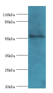 Western blot<br />All lanes: RBMY1F Polyclonal Antibody at 2ug/ml+PC-3 whole cell lysate<br />Secondary<br />Goat polyclonal to rabbit at 1/10000 dilution<br />Predicted band size: 56kDa <br />Observed band size: 56kDa <br />