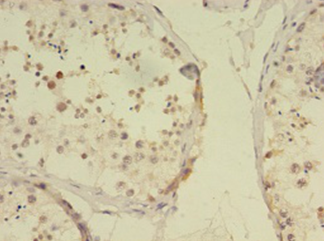 Immunohistochemistry of paraffin-embedded human testis tissue using RBMY1F Polyclonal Antibody at dilution 1:100