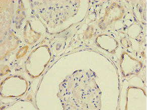 Immunohistochemistry of paraffin-embedded human kidney tissue using LY6E Polyclonal Antibody at dilution 1:100