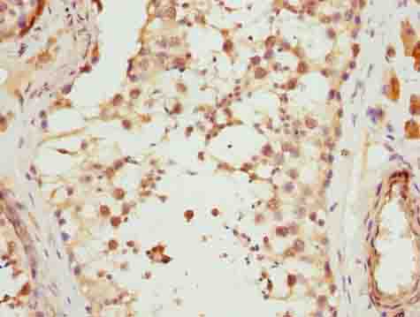 MAD2L1 Polyclonal Antibody