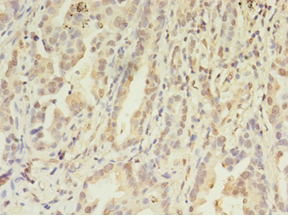 FGL2 Polyclonal Antibody