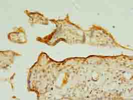 TSPAN31 Polyclonal Antibody