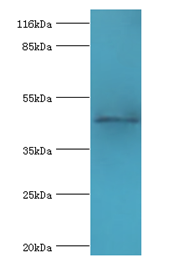 E2F2 Polyclonal Antibody (100 µl)