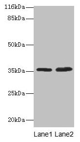 ACKR1 Polyclonal Antibody