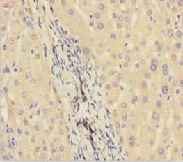 C11orf73 Polyclonal Antibody