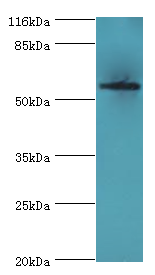 Western blot<br />All lanes: ACBD5 Polyclonal Antibody at 2ug/ml+Hela whole cell lysate<br />Secondary<br />Goat polyclonal to rabbit at 1/10000 dilution<br />Predicted band size: 60kDa <br />Observed band size: 60kDa <br />