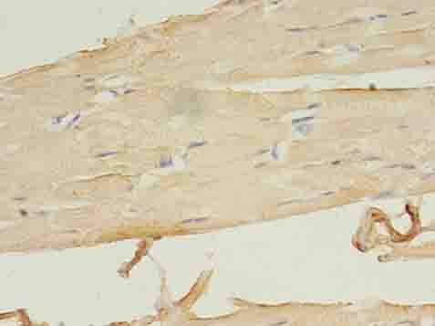 LRRN1 Polyclonal Antibody