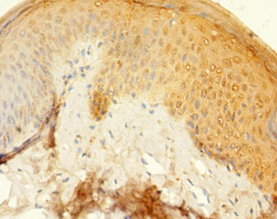 KRT77 Polyclonal Antibody
