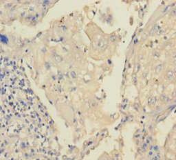 TRPM8 Polyclonal Antibody