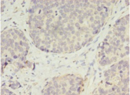 VASH2 Polyclonal Antibody