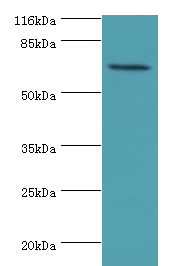 KBTBD2 Polyclonal Antibody