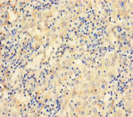 CCDC36 Polyclonal Antibody