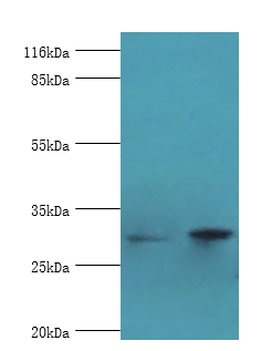 ACBD4 Polyclonal Antibody