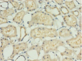 Immunohistochemistry of paraffin-embedded human kidney using ACBD4 Polyclonal Antibody at dilution 1:100