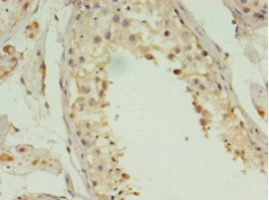 Immunohistochemistry of paraffin-embedded human testis tissue using ACBD4 Polyclonal Antibody at dilution 1:100