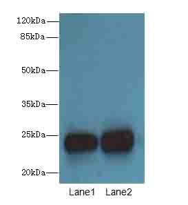 N6AMT2 Polyclonal Antibody