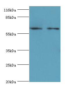 GALNT14 Polyclonal Antibody