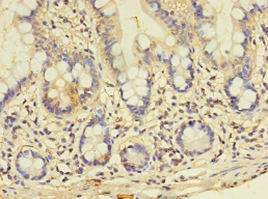 Immunohistochemistry of paraffin-embedded human small intestine using GALNT14 Polyclonal Antibody at dilution 1:100