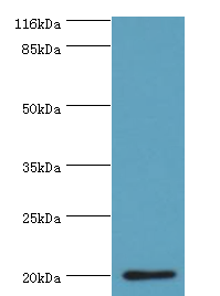 HDDC3 Polyclonal Antibody