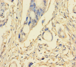 PIK3R5 Polyclonal Antibody