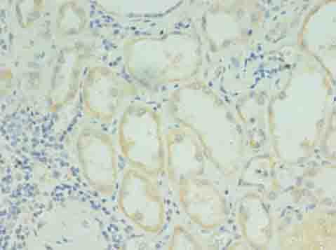 Immunohistochemistry of paraffin-embedded human kidney tissue using RDH12 Polyclonal Antibody at dilution of 1:100