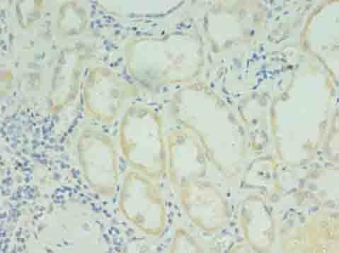 RDH12 Polyclonal Antibody