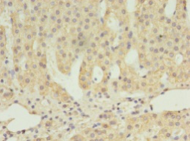 SCARB1 Polyclonal Antibody