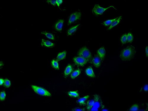 Immunofluorescent analysis of HepG2 cells using ABHD3 Polyclonal Antibody at a dilution of 1:100 and Alexa Fluor 488-congugated AffiniPure Goat Anti-Rabbit IgG(H+L)