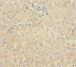 MLKL Polyclonal Antibody