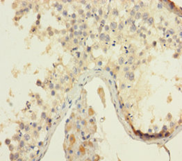 HMGB4 Polyclonal Antibody