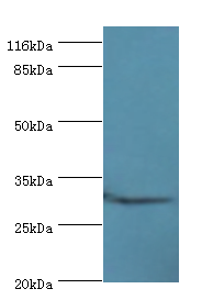 C2orf47 Polyclonal Antibody