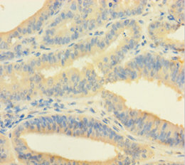 EME1 Polyclonal Antibody