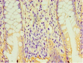 GPA33 Polyclonal Antibody