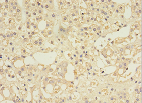 MYCBP Polyclonal Antibody