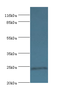 DUSP26 Polyclonal Antibody