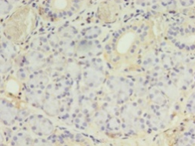 PLCD4 Polyclonal Antibody