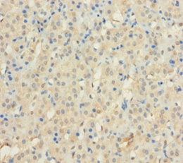 C12orf49 Polyclonal Antibody